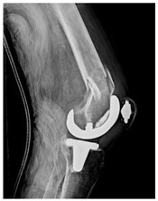 Figure 39