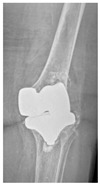Figure 41