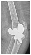 Figure 42