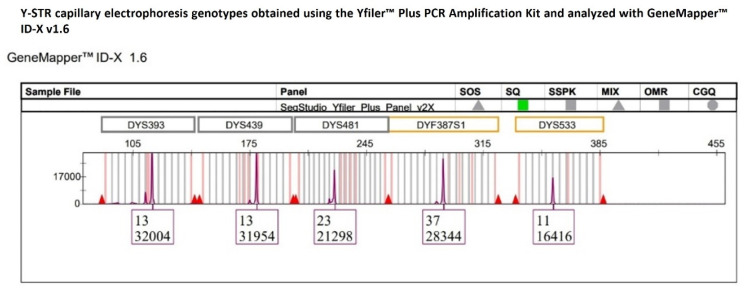 Figure 11