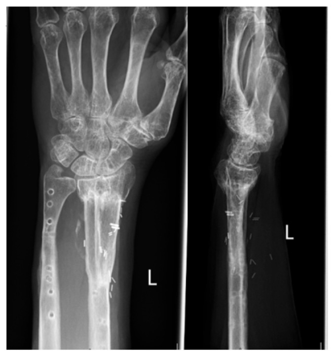 Figure 9