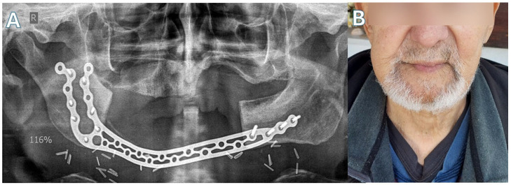 Figure 8