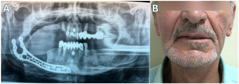 Figure 10