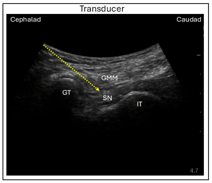 Figure 7