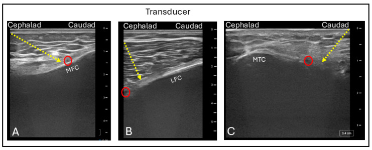 Figure 12