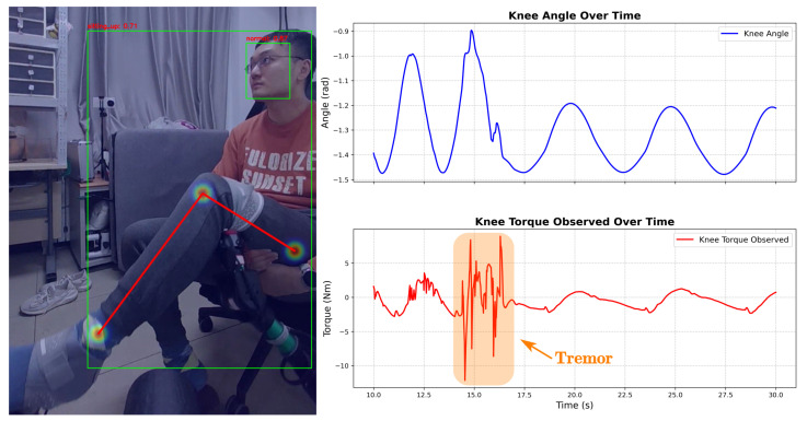 Figure 12
