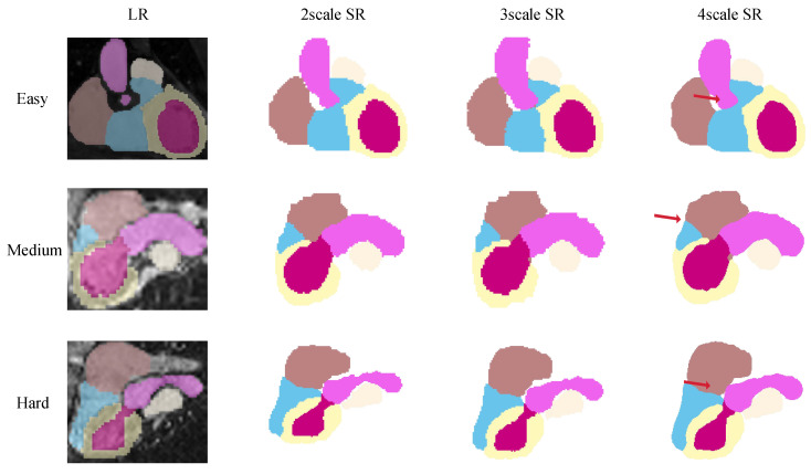 Figure 9