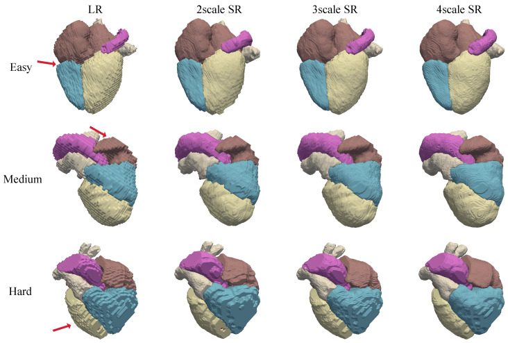 Figure 10