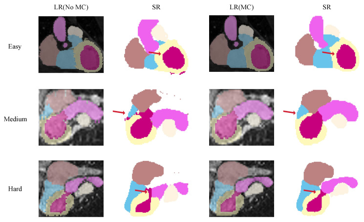 Figure 11