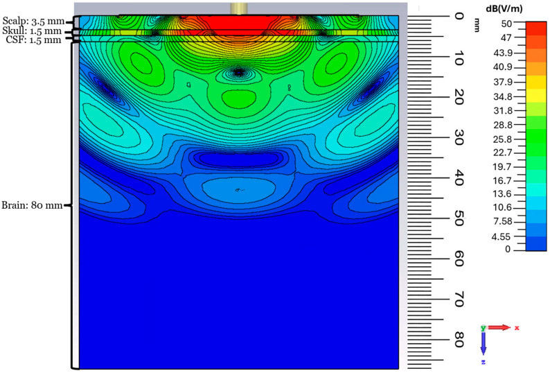 Figure 15