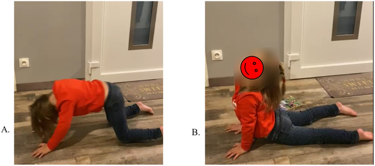 Fig 3