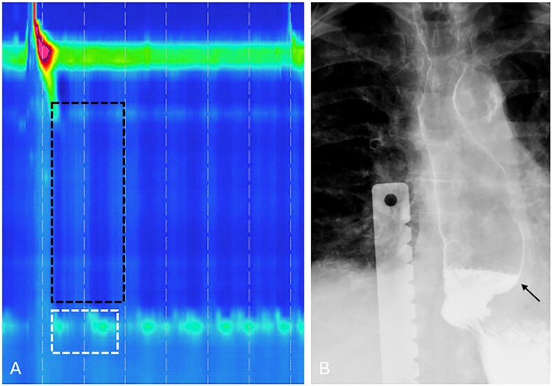 Figure 10