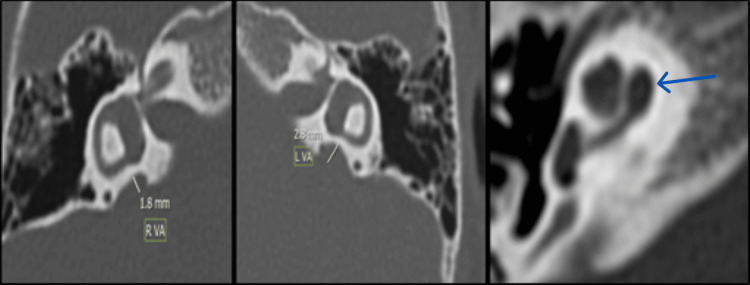 Figure 9