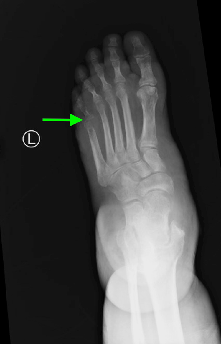 Figure 6