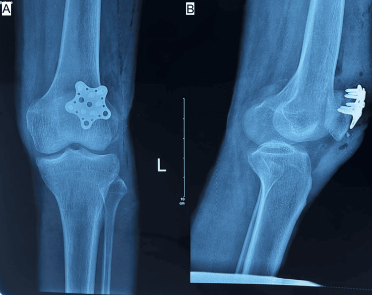 Figure 5