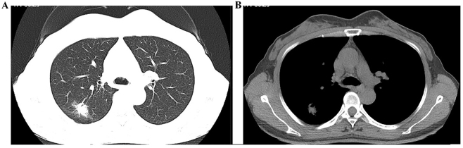 Figure 1