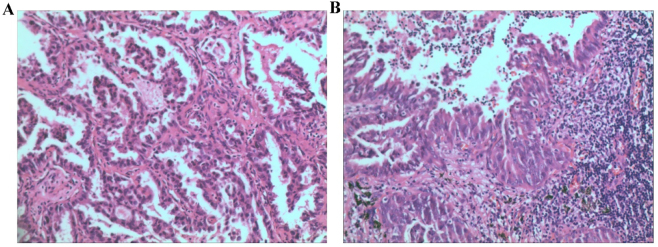 Figure 2