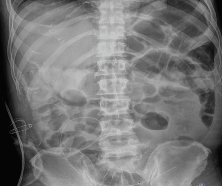 Figure 9