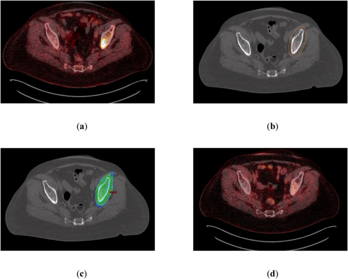FIGURE 2