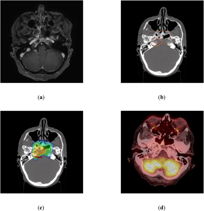 FIGURE 1