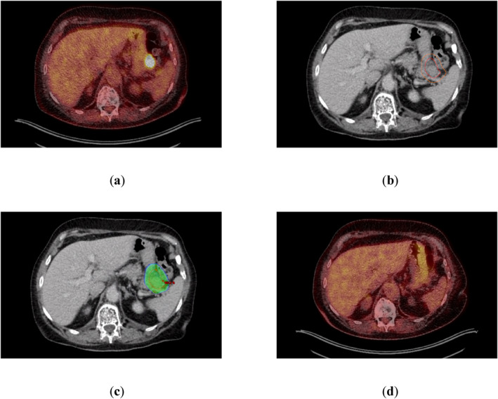FIGURE 3
