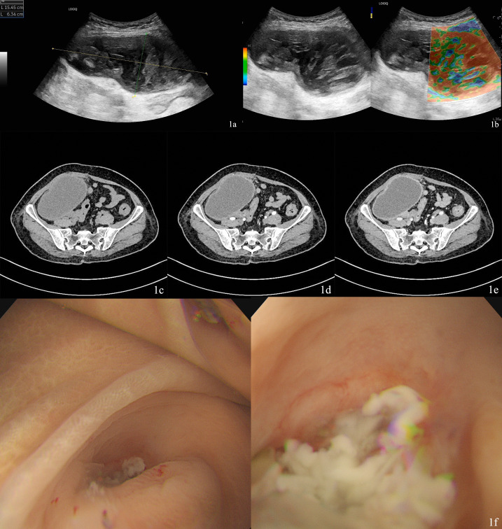 Figure 1