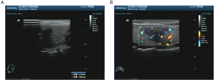 Figure 2