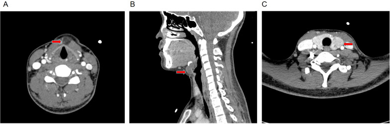 Figure 3
