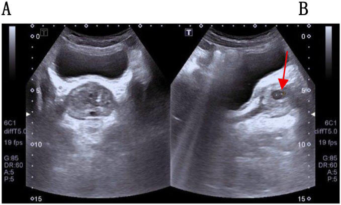 Figure 1