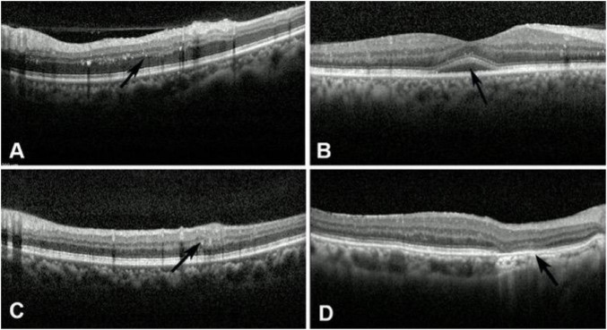FIGURE 4