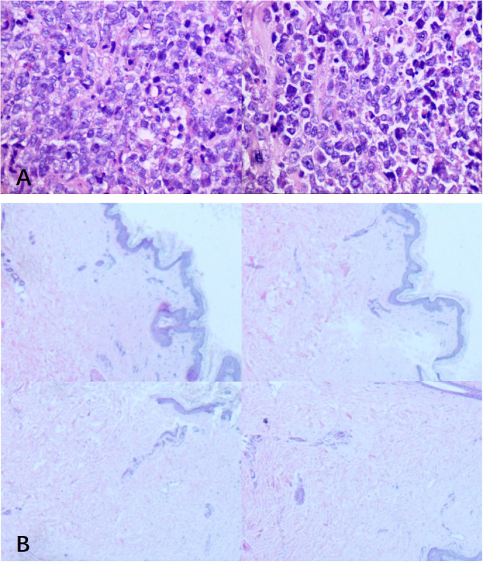 Figure 4