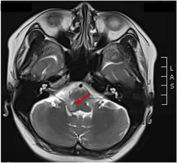 FIGURE 3