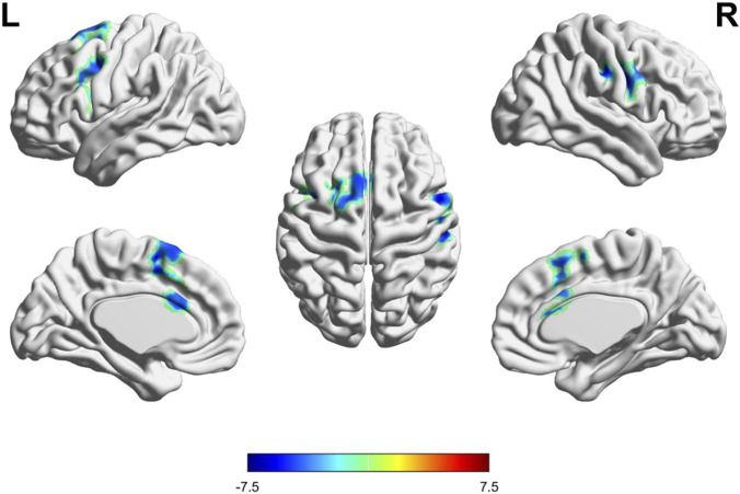 FIGURE 3