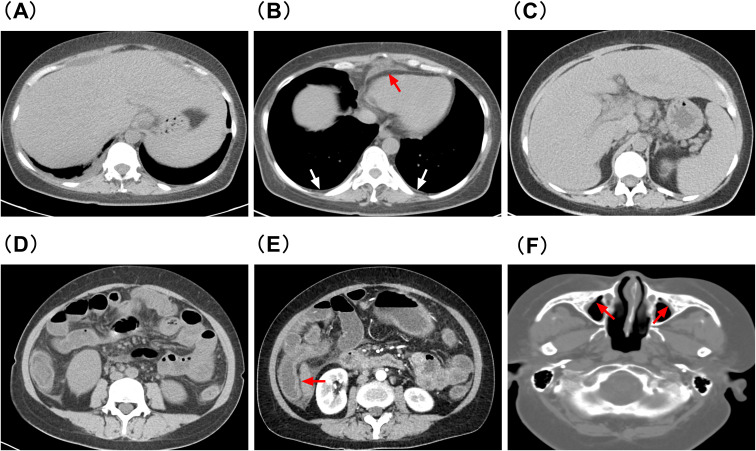 Figure 2