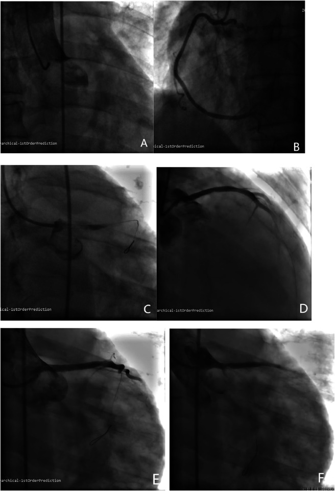 Figure 2