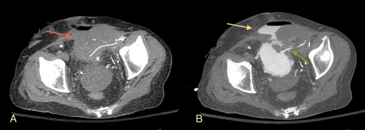 Figure 6