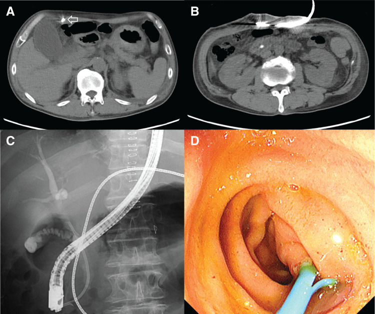 Fig. 1