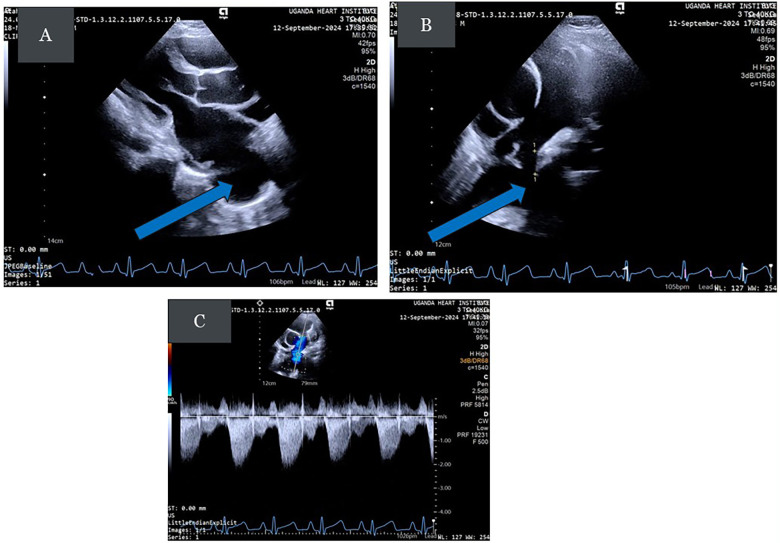 Figure 2