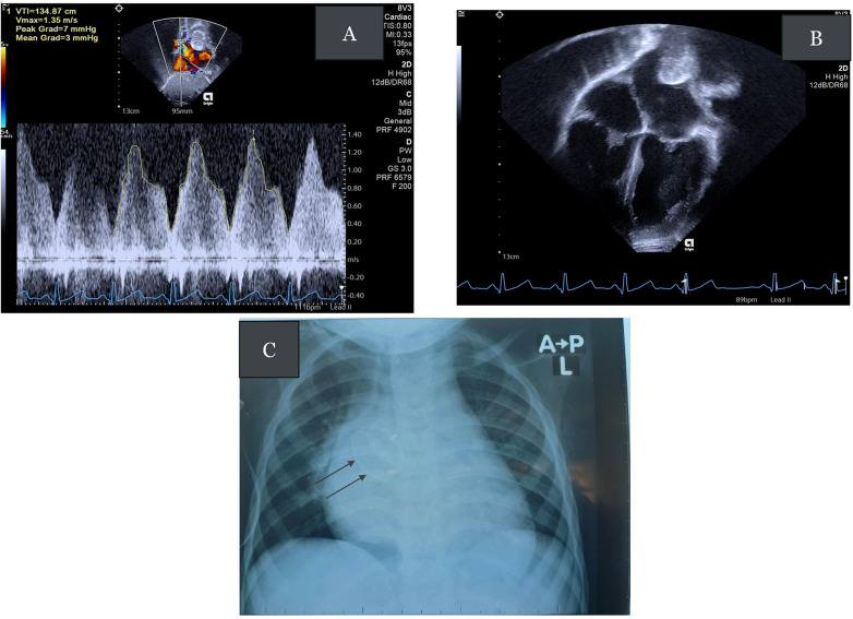 Figure 4