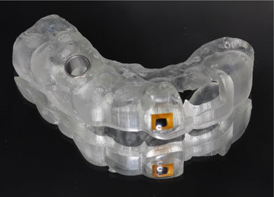 FIGURE 3