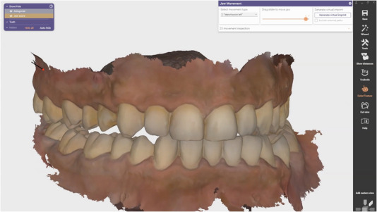 FIGURE 5