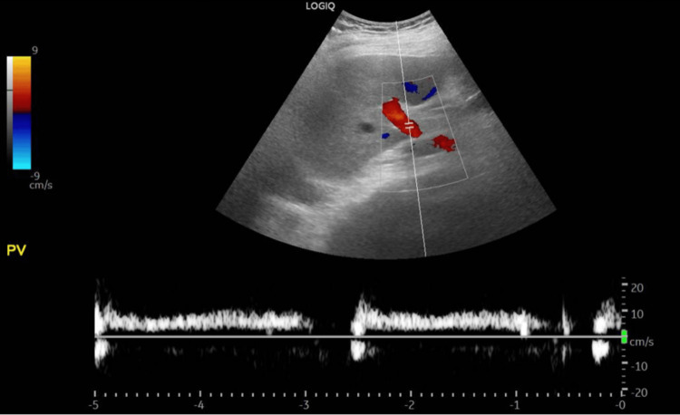 Figure 10