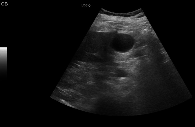 Figure 11