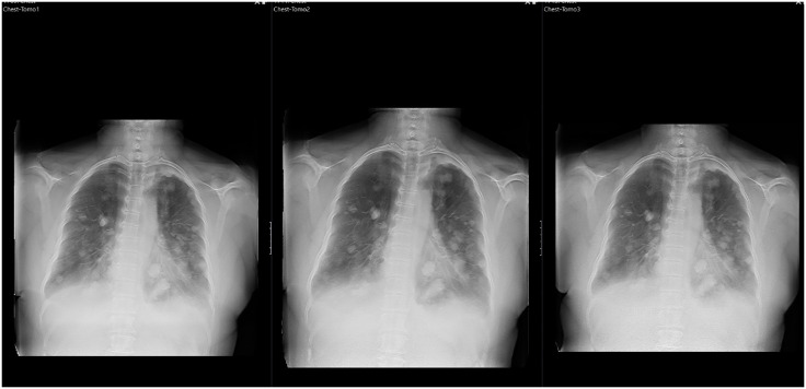 Fig 1