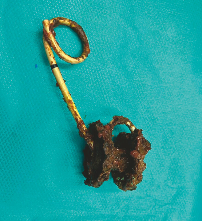 Fig. 2