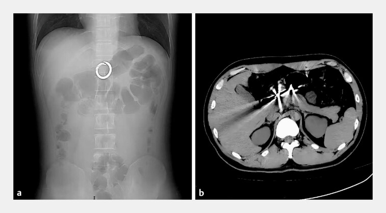 Fig. 1