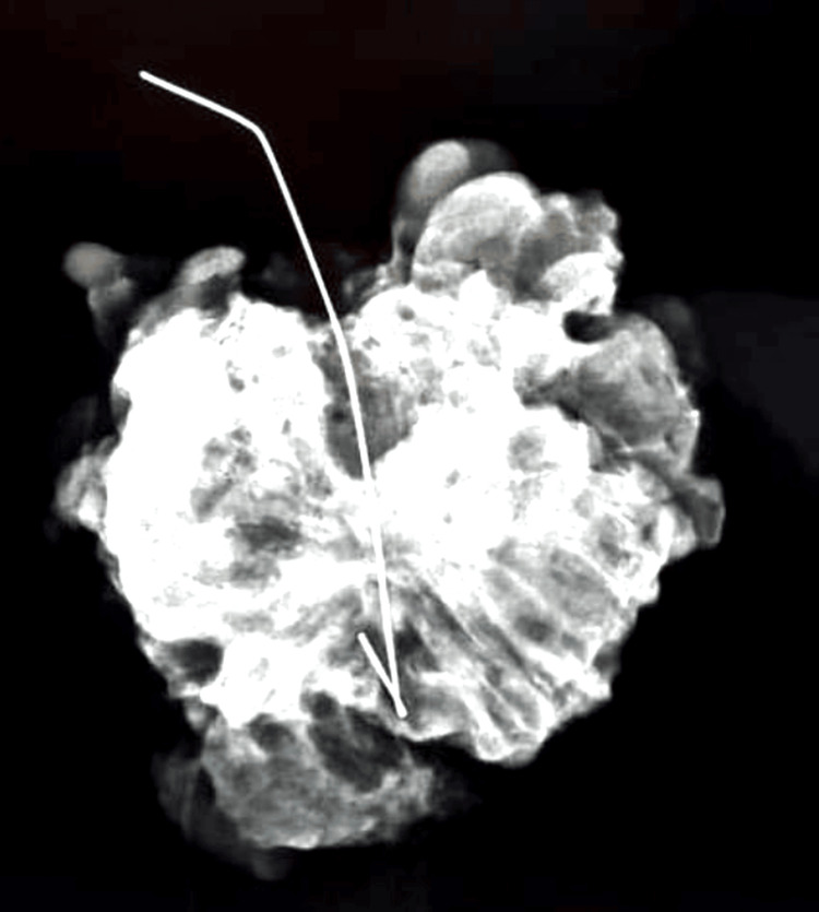 Figure 13