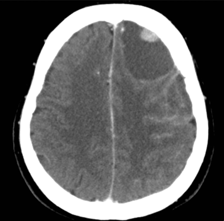 Figure 5