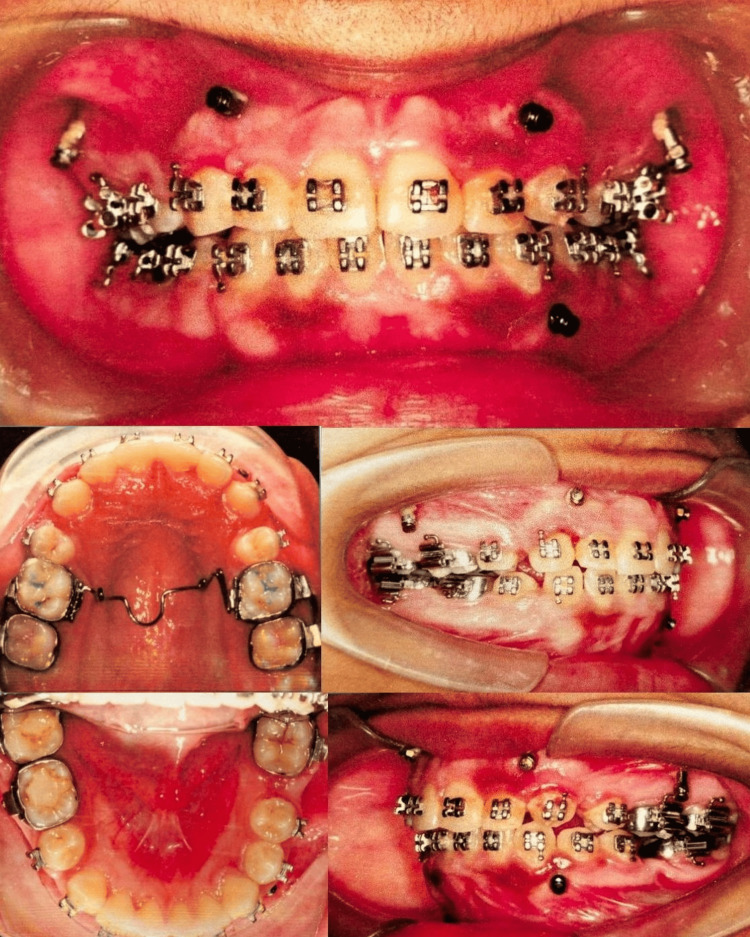 Figure 4