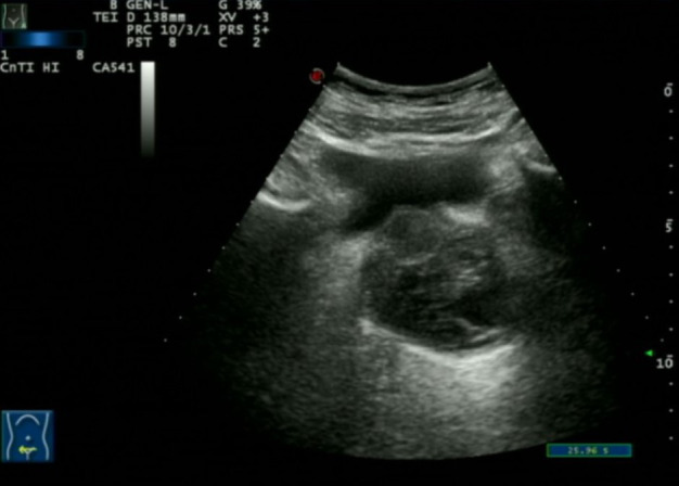 Figure 1